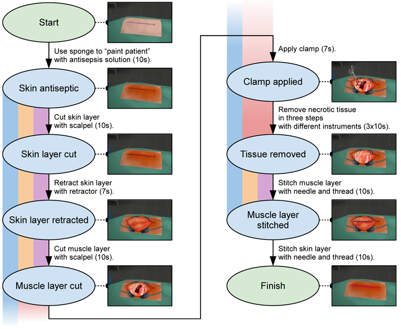 Overview of the steps of the simulated surgical procedure and the instruments necessary to reach the next step. The coloured vertical areas symbolise the sections of the procedure during which the events in Figure 7 can occur.